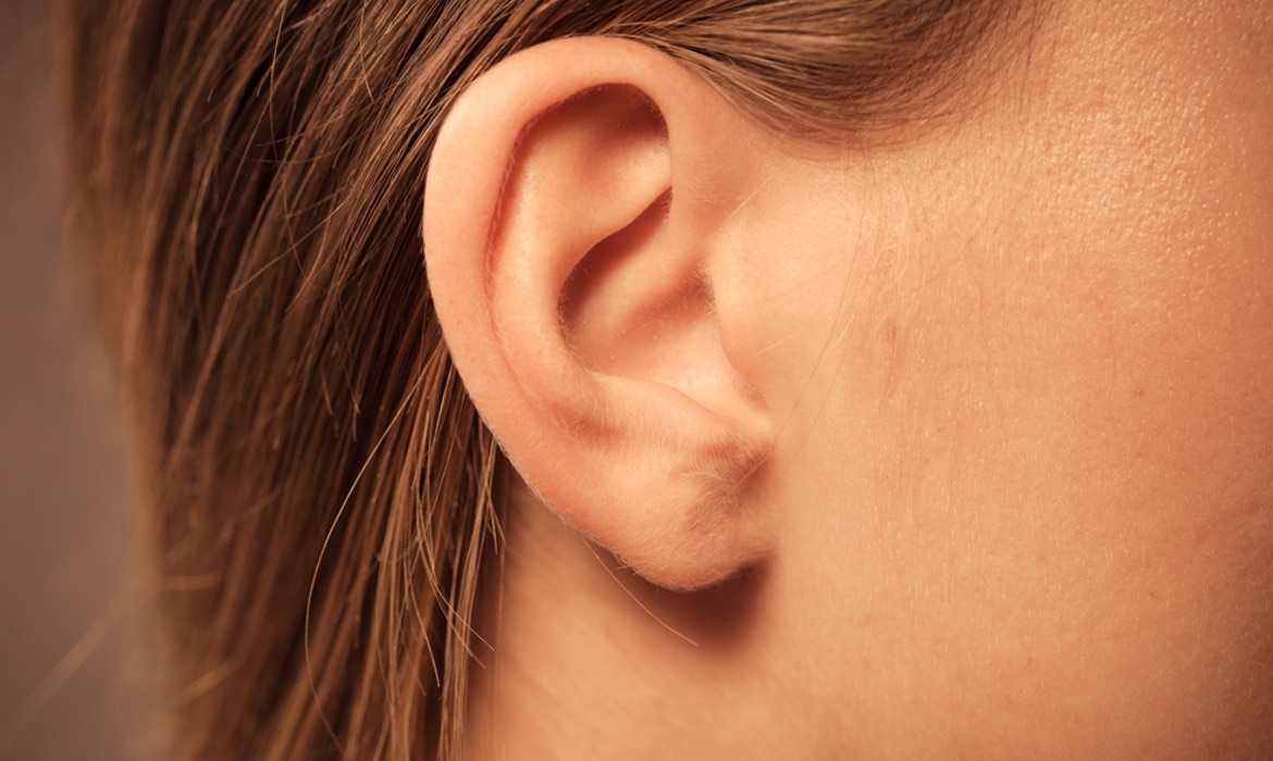 Otoplastia Otoplastia