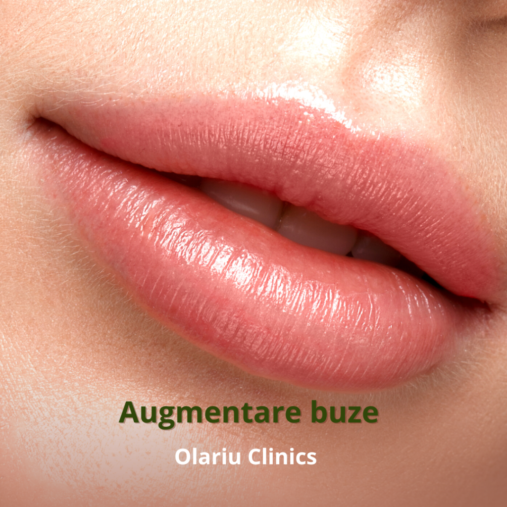 augmentare buze