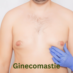 ginecomastie