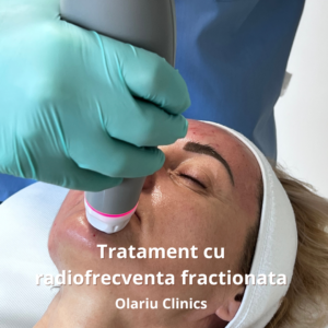 radiofrecventa fractionata