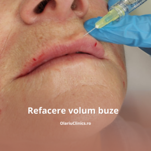 volum buze acid hialuronic