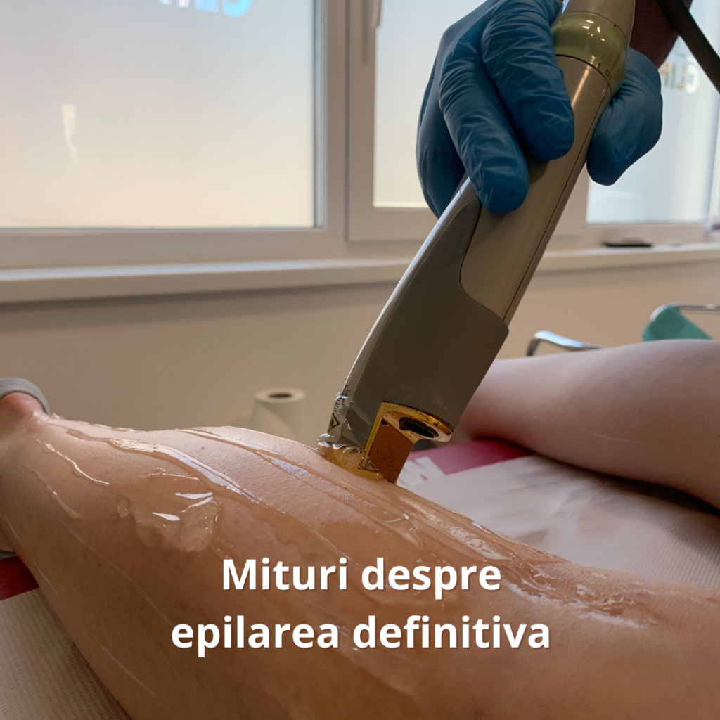epilarea definitiva