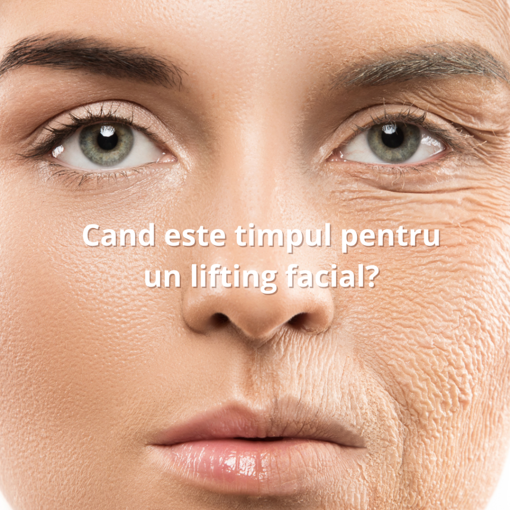Cand este momentul pentru un lifting facial? lifting facial