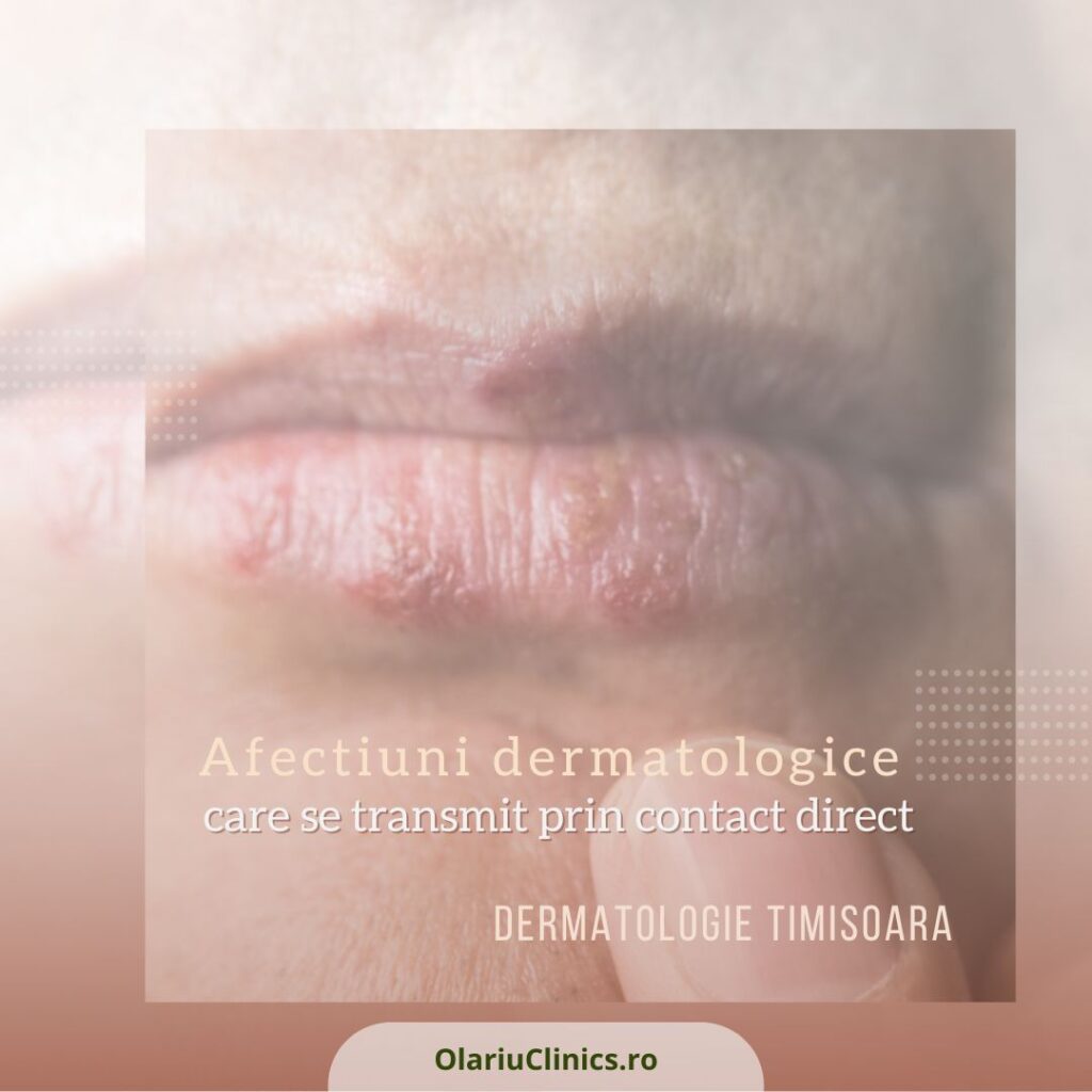 Afectiuni dermatologice care se transmit prin contact direct afectiuni dermatologice