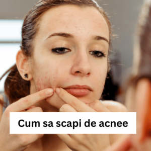 cum sa scapi de acnee