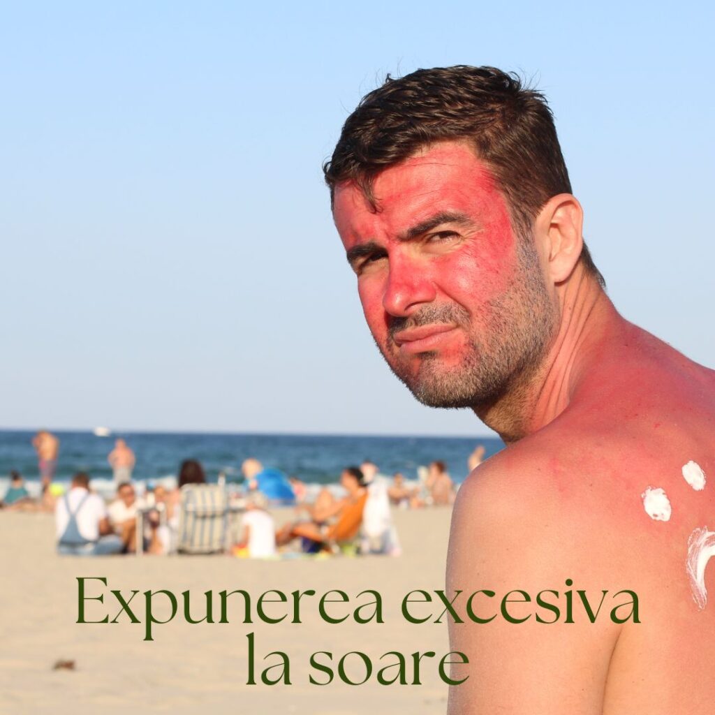 expunerea excesiva la soare