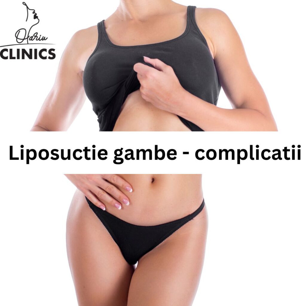 liposuctie gambe