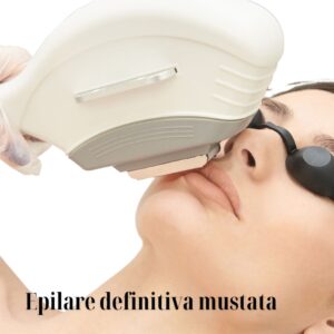 epilare definitiva mustata