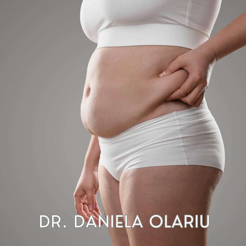 Intrebari despre abdominoplastie intrebari despre abdominoplastie